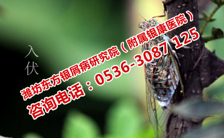 三伏天牛皮癣护理要注意方方面面