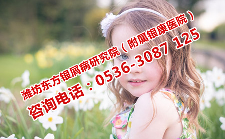 小孩牛皮癣治疗